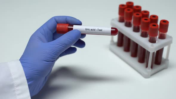 Uric Acid, Doctor Showing Blood Sample in Tube, Lab Research, Health Checkup