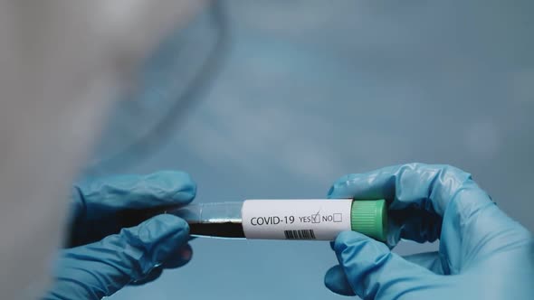 Closeup of Microbiologist or Medical Worker Hand with Blue Surgical Gloves Looking Blood Test Result