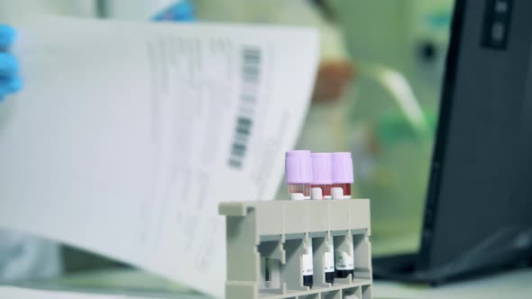 Laboratory Worker Is Putting Together Tubes with Blood. Coronavirus, Covid-19 Laboratory Test.