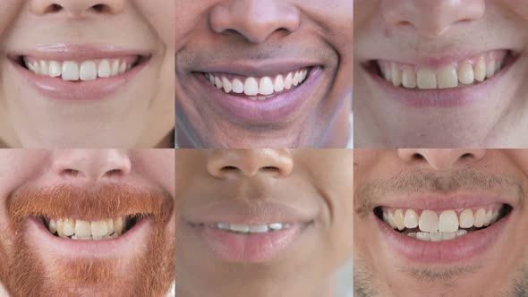 Collage of Smiling Young People, Lips and Teeth Close Up