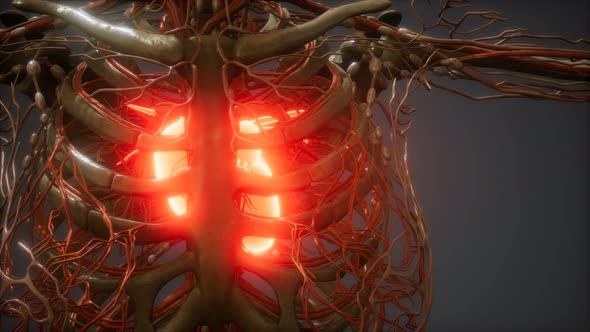 CG Animation Of A Sick Human Heart