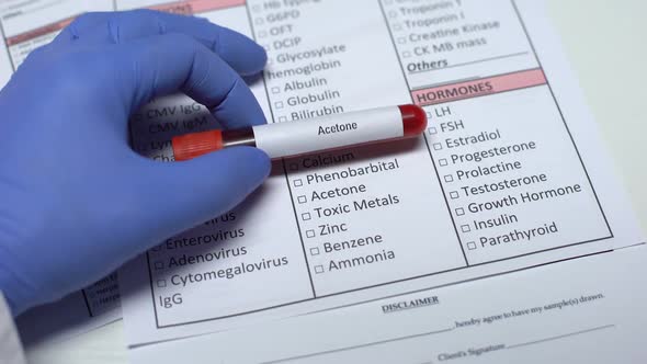 Acetone, Doctor Checking Disease in Lab Blank, Showing Blood Sample in Tube