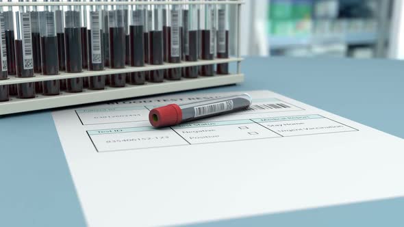 Result of a Biochemical Analysis in Research Lab