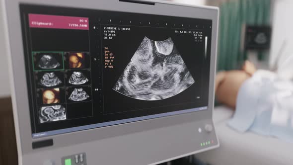 Pregnancy Diagnostic Scanner Displays And Analyzes Vital Signs Of Child In Belly