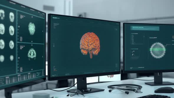 Monitoring the brain tumour growth using the medical anatomical scanner alt