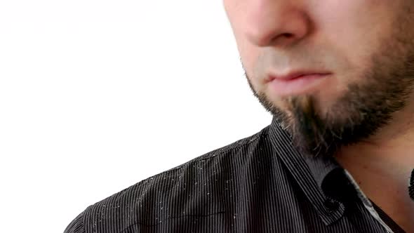 Bearded man in a black shirt look at dandruff of his shoulder. Close-up
