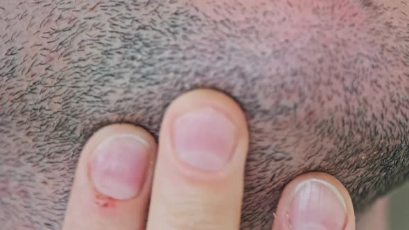 Male Bristle Closeup Young Man Touching By Hand the Stubble on His Face