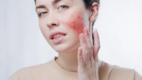 Close-up portrait of a young beautiful woman touching the redness on her cheek with her fingers.