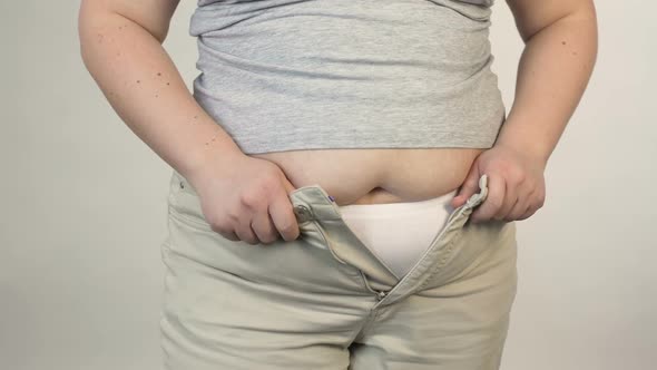 Overweight Female Trying to Button Trousers Before Camera, Obesity, Plus Size