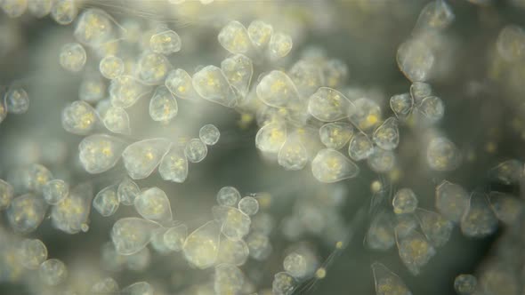 Infusoria Vorticella Under the Microscope, Class Oligohymenophorea. Sample Found at Lake Baikal