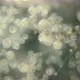 Infusoria Vorticella Under the Microscope, Class Oligohymenophorea. Sample Found at Lake Baikal - VideoHive Item for Sale