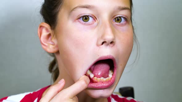 Girl Trying to Remove Baby Tooth with Tongue