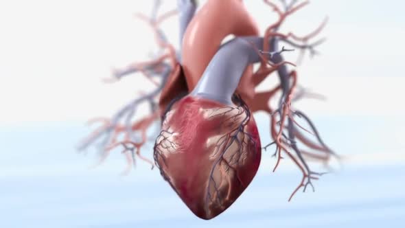 Acute Coronary Syndrome 3d medical