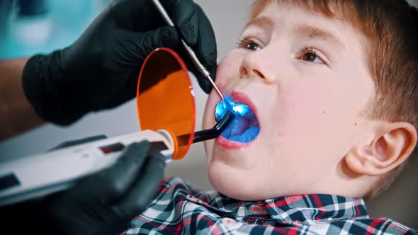 A Little Boy Having His Tooth Done - Putting the Photopolymer Lamp in the Mouth and Turning It on
