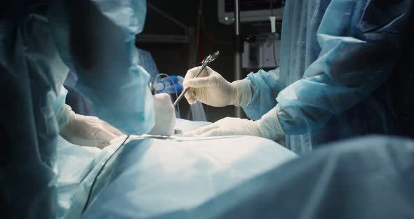 A Team of Surgeons Perform an Operation in a Bright Operating Room