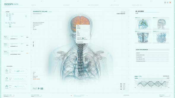 Modern Anatomical Diagnostic Analysis Software Finds Tumor In Patients Brain alt