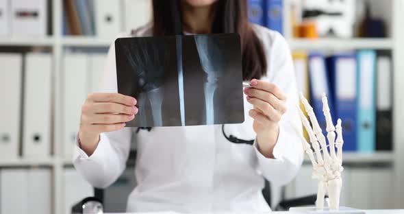 The Doctor Shows an Xray of the Wrist Closeup