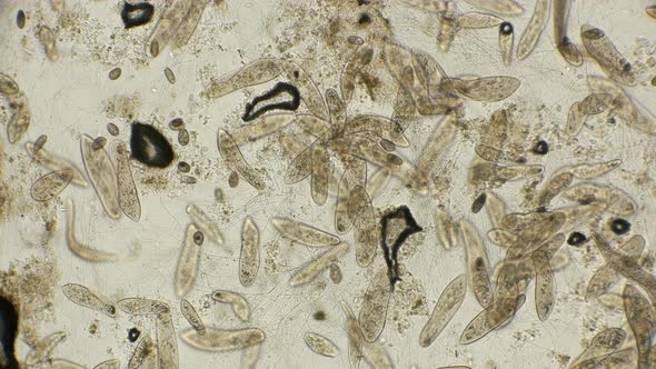 Big Colony Infusorium Paramécium Caudátum in Motion, Under a Microscope