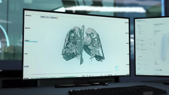 Medical Mri Scan Lung Cancer Diagnosis By Scientific Software Interface alt