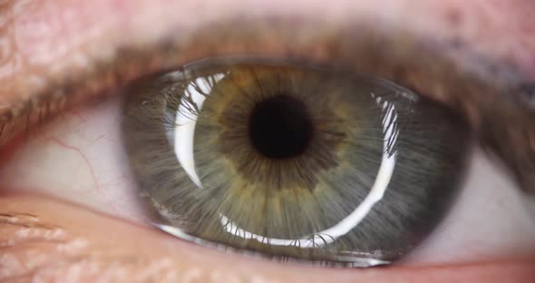 Human Eye with Gray Green Pupil Slow Motion  Movie