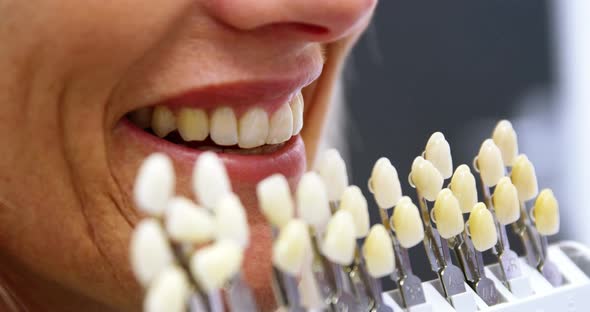 Dentist holding teeth shades against female patient