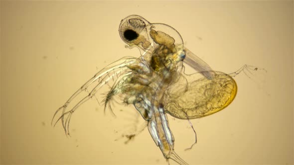 Zooplankton Under a Microscope, Prickly Water Flea