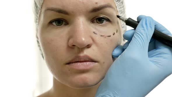 Preparing the Female Patient for Blepharoplasty