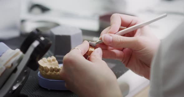 A dental technician holds a mock-up of the jaw (articulator) in his hands.