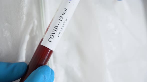 Medic person holds test tube with negative analysis of red thick blood by COVID-19 virus threat