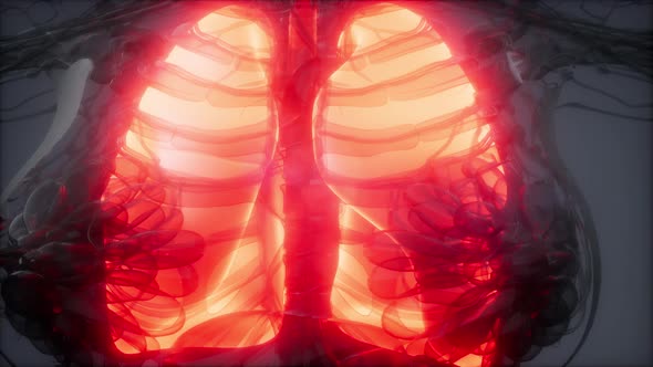 Human Lungs Radiology Exam alt