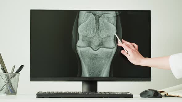 Doctor Veterinarian Examining Horse Leg Skeleton Roentgen on Computer Monitor