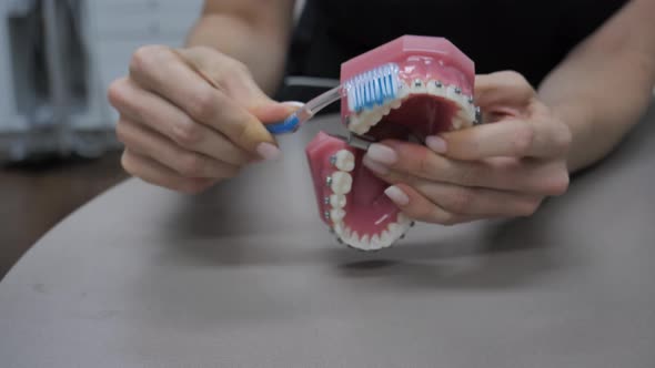 A woman brushes teeth with braces