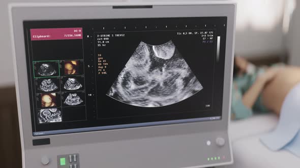 Pregnant Belly Examination By Ultrasound Scanner Device In Medical Hospital Room alt