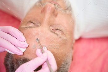 ace of male patient in beauty salon. Cropped photo
