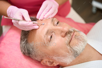  face of man patient from acne in beauty salon. Cropped photo