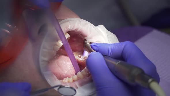 Dentist Conducts Dental Hygiene To the Patient