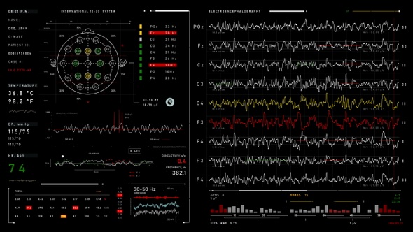 Electroencephalography (4K Medical Panel 5in1)