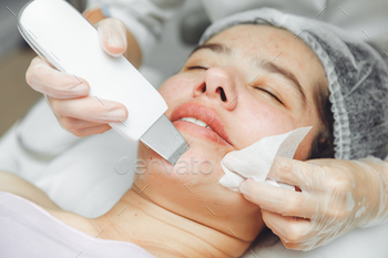 ocedure. Salon skin care procedure. Professional hardware peeling. Acne removal. contaminated person
