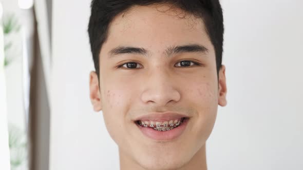 Portrait of Asian Teenager Smiling to Camera He Wears Dental Braces Brackets