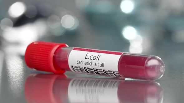 E.coli Escherichia coli antibodies vial in medical lab