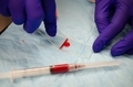 Making blood smear over a glass slide  - PhotoDune Item for Sale