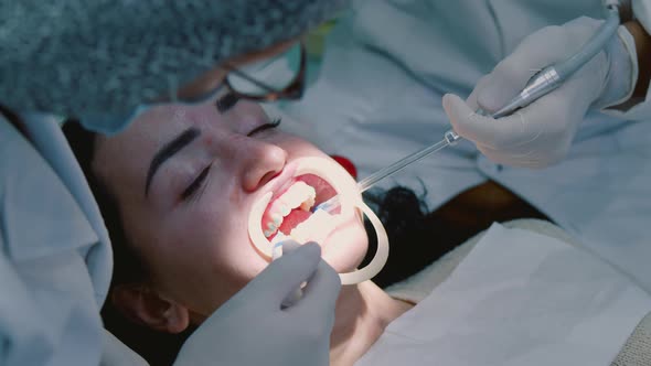 Female Dentist Applies a Special Adhesive to Set the Staples to Straighten the Teeth