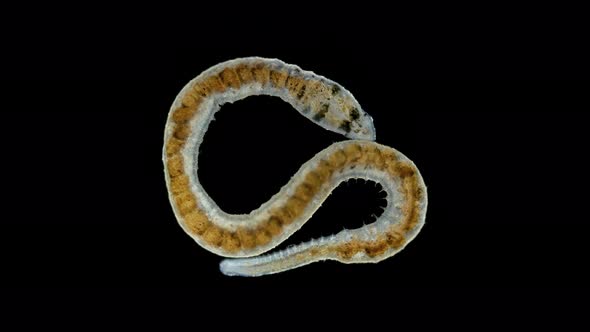 Ophidonais serpentina worm under a microscope, Oligochaeta Subclass