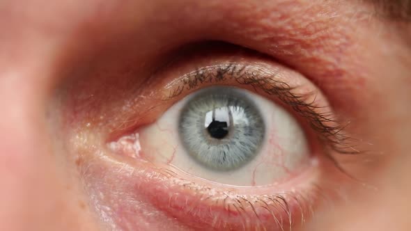 Large Gray Eye Close. Tired Eyes With Red Veins