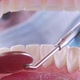 Dentist Inspects Patient's Teeth with Probe and Mirror - VideoHive Item for Sale
