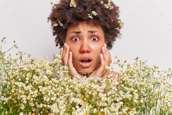 womangrabs face gasps and has shortness of breath because of allergy surrounded by camomile flowers has red itchy eyes isolated on white wall
