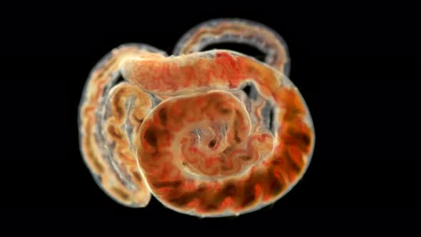 Tubifex Worm Under a microscope,Oligochaeta the Naididae Family, Type Annelida