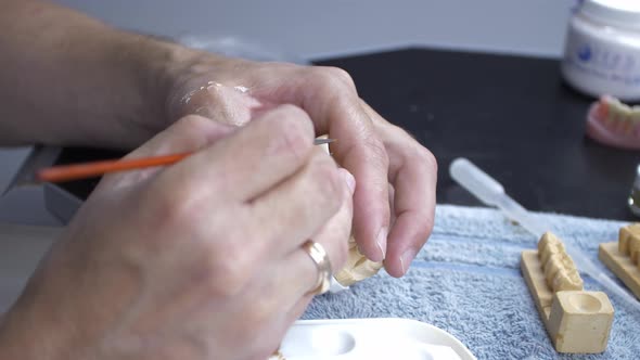 The Process of Creating a Dental Prosthesis for a Person