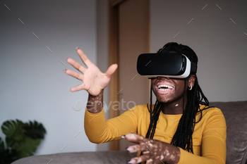 Excited black woman with vitiligo skin playing VR game