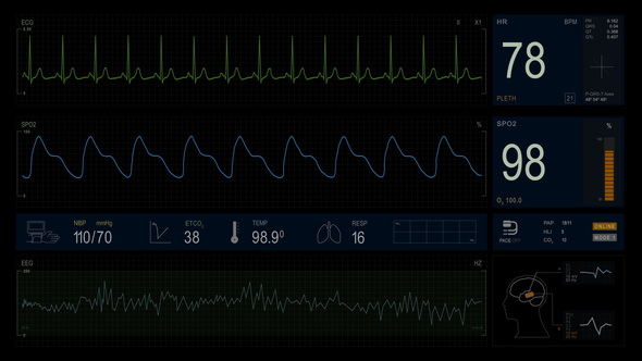Cardiac Monitor 4K (20 curves)